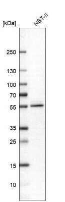 Western Blot: ALDH9A1 Antibody [NBP1-89150]