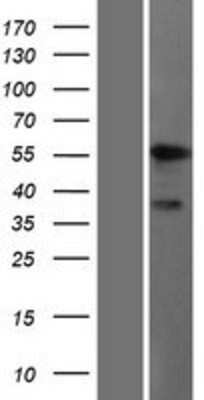 Western Blot: ALDH9A1 Overexpression Lysate [NBP2-09000]