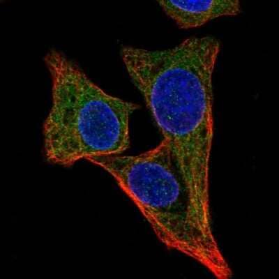 Immunocytochemistry/ Immunofluorescence: ALG1 Antibody [NBP2-32539]