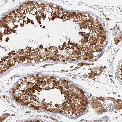 Immunohistochemistry-Paraffin: ALG1 Antibody [NBP2-32539]