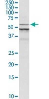 Western Blot: ALG1 Antibody [H00056052-D01P]