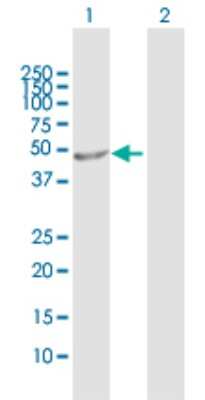 Western Blot: ALG1 Antibody [H00056052-D01P]