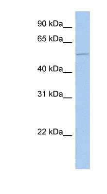 Western Blot: ALG1 Antibody [NBP1-62497]