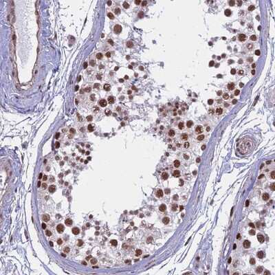 Immunohistochemistry-Paraffin: ALG10 Antibody [NBP2-14281]