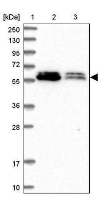 Western Blot: ALG10 Antibody [NBP2-14281]