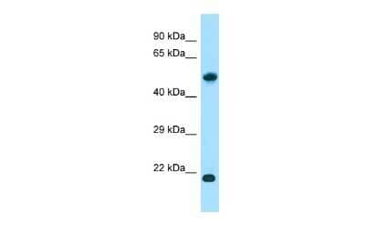 Western Blot: ALG10B Antibody [NBP3-09560]