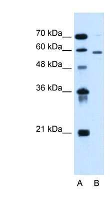 Western Blot: ALG11 Antibody [NBP1-91577]