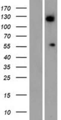 Western Blot: ALG11 Overexpression Lysate [NBP2-08931]