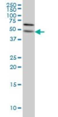 Western Blot: ALG12 Antibody (5E3) [H00079087-M06]