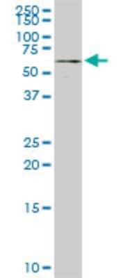 Western Blot: ALG12 Antibody (5E3) [H00079087-M06]