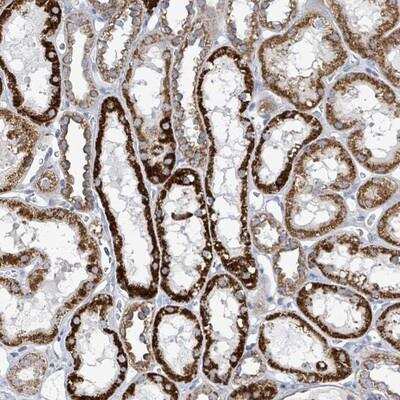 Immunohistochemistry-Paraffin: ALG12 Antibody [NBP2-14282]