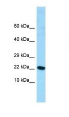 Western Blot: ALG13 Antibody [NBP1-98323]