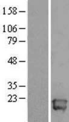 Western Blot: ALG13 Overexpression Lysate [NBL1-07465]