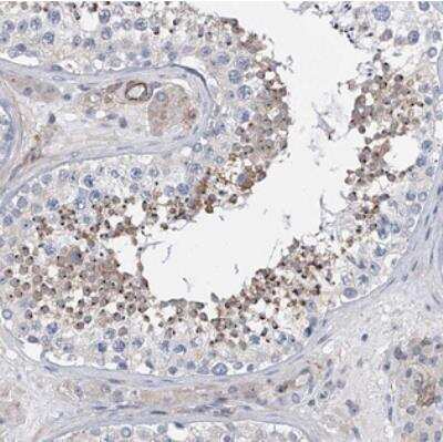 Immunohistochemistry: ALG14 Antibody [NBP2-30914]