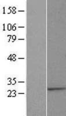 Western Blot: ALG14 Overexpression Lysate [NBL1-07466]