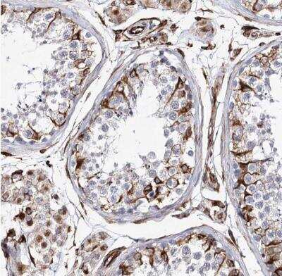 Immunohistochemistry-Paraffin: ALG1L Antibody [NBP1-90862]