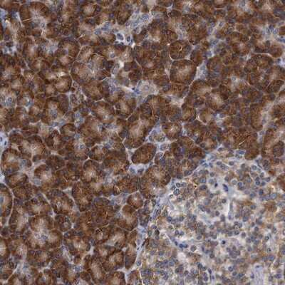 Immunohistochemistry-Paraffin: ALG2 Antibody [NBP1-84569]