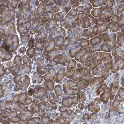 Immunohistochemistry-Paraffin: ALG2 Antibody [NBP1-85715]