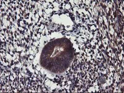 Immunohistochemistry: ALG2 Antibody (OTI3C2) - Azide and BSA Free [NBP2-72308]