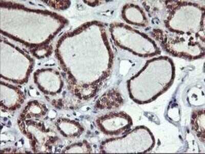Immunohistochemistry-Paraffin: ALG2 Antibody (OTI3C2) [NBP2-01734]