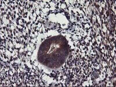 Immunohistochemistry-Paraffin: ALG2 Antibody (OTI3C2) [NBP2-01734]