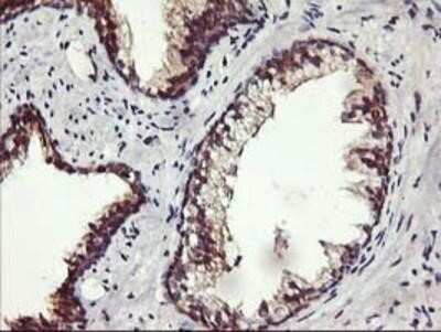 Immunohistochemistry-Paraffin: ALG2 Antibody (OTI3C2) [NBP2-01734]