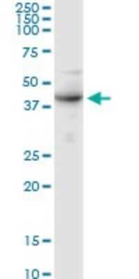 Western Blot: ALG2 Antibody [H00085365-D01P]