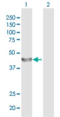 Western Blot: ALG2 Antibody [H00085365-D01P]