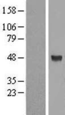 Western Blot: ALG2 Overexpression Lysate [NBL1-07467]