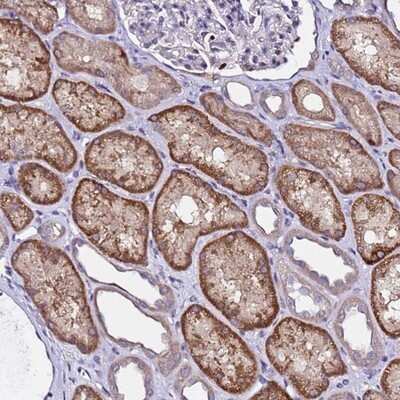 Immunohistochemistry-Paraffin: ALG3 Antibody [NBP1-91658]
