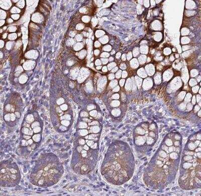 Immunohistochemistry-Paraffin: ALG3 Antibody [NBP1-91658]