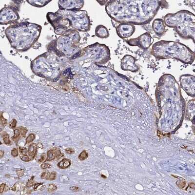 Immunohistochemistry-Paraffin: ALG3 Antibody [NBP1-91658]