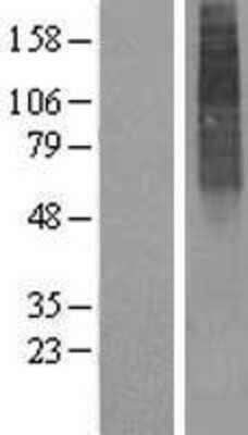 Western Blot: ALG3 Overexpression Lysate [NBP2-07704]