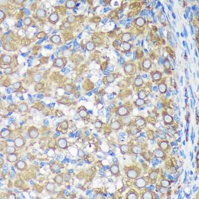 Immunohistochemistry-Paraffin: ALG5 Antibody - Azide and BSA Free [NBP2-92371]