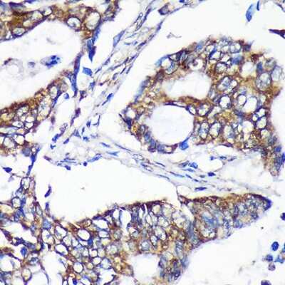 Immunohistochemistry-Paraffin: ALG5 Antibody - Azide and BSA Free [NBP2-92371]