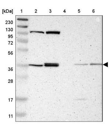 Western Blot: ALG5 Antibody [NBP1-88767]