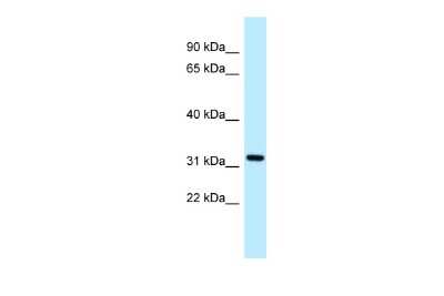 Western Blot: ALG5 Antibody [NBP2-86978]