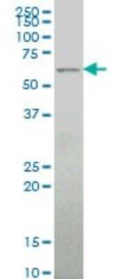 Western Blot: ALG6 Antibody (2G11) [H00029929-M09]