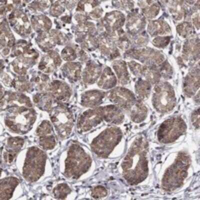 Immunohistochemistry-Paraffin: ALG6 Antibody [NBP3-17210]