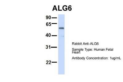 Western Blot: ALG6 Antibody [NBP1-62494]