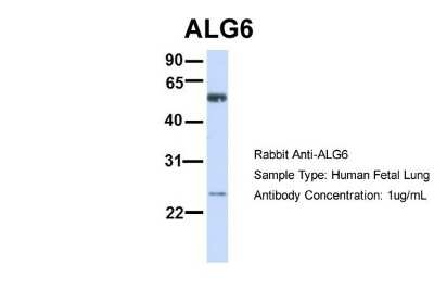 Western Blot: ALG6 Antibody [NBP1-62494]
