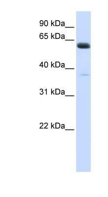 Western Blot: ALG6 Antibody [NBP1-62495]