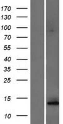 Western Blot: ALG6 Overexpression Lysate [NBP2-07417]