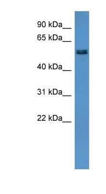 Western Blot: ALG8 Antibody [NBP1-69028]