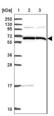 Western Blot: ALG8 Antibody [NBP2-47550]