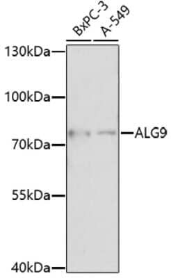 Western Blot: ALG9 AntibodyAzide and BSA Free [NBP2-92351]