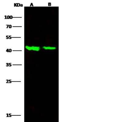 Western Blot: ALK-1 Antibody (124) [NBP2-89257]