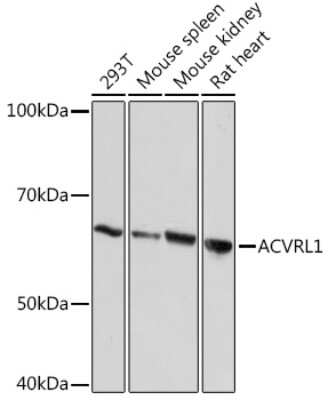 Western Blot: ALK-1 Antibody (8L2V7) [NBP3-16876]