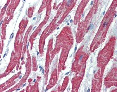 Immunohistochemistry-Paraffin: ALK-1 Antibody [NBP1-30982]
