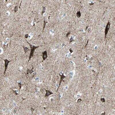 Immunohistochemistry-Paraffin: ALK-1 Antibody [NBP1-90254]